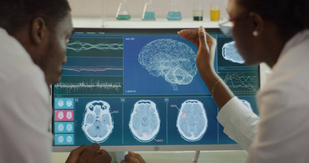 Examen d'imagerie cérébrale affiché sur des écrans médicaux